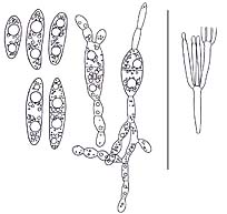 Ascocoryne sarcoides , r&oslash;dlilla sejskive, Purple Jellydisc, s&oslash;skenfiolbeger, violett gelésk&aring;l, P&aring;rse knoopzwam, Fleischroter Gallertbecher, Ascocoryne charnue